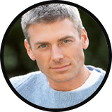 Mens hair loss photo of full head of hair