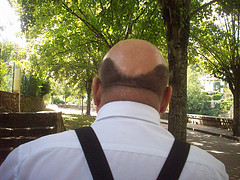 Best Hair Loss Advice in Maghull 